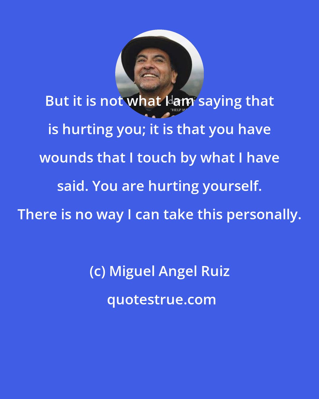 Miguel Angel Ruiz: But it is not what I am saying that is hurting you; it is that you have wounds that I touch by what I have said. You are hurting yourself. There is no way I can take this personally.