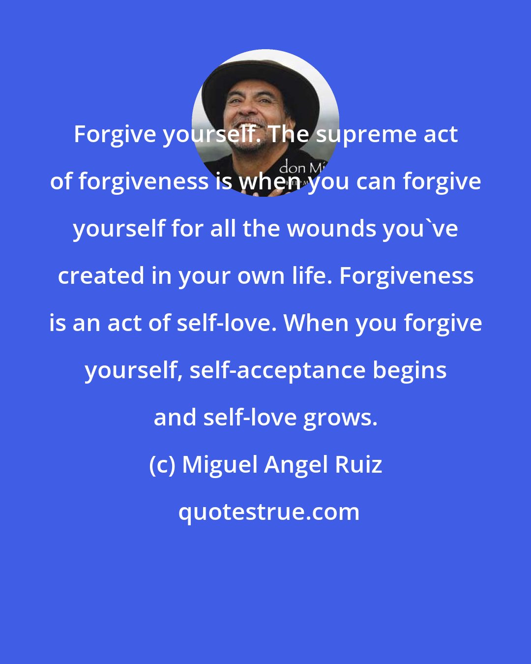 Miguel Angel Ruiz: Forgive yourself. The supreme act of forgiveness is when you can forgive yourself for all the wounds you've created in your own life. Forgiveness is an act of self-love. When you forgive yourself, self-acceptance begins and self-love grows.