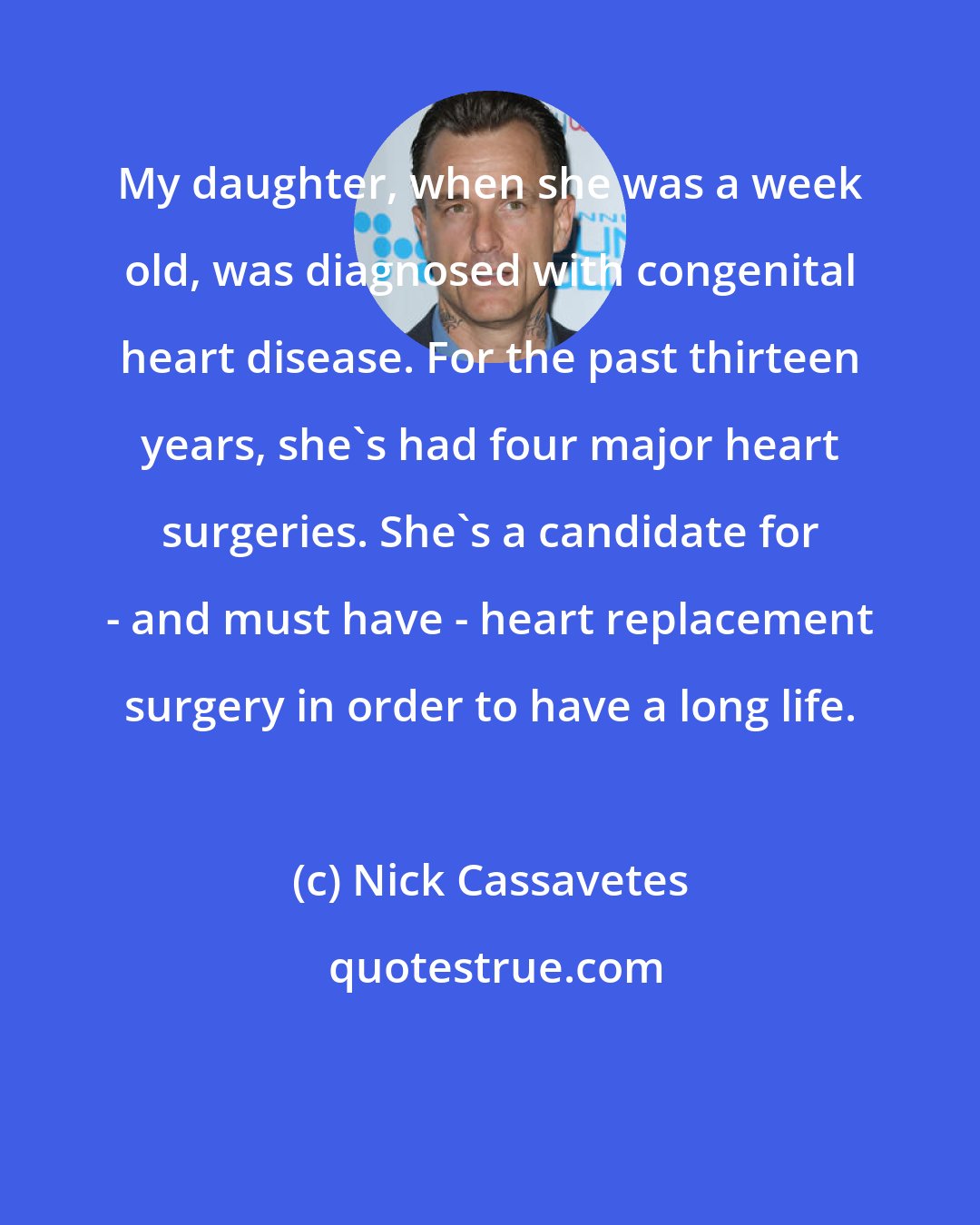 Nick Cassavetes: My daughter, when she was a week old, was diagnosed with congenital heart disease. For the past thirteen years, she's had four major heart surgeries. She's a candidate for - and must have - heart replacement surgery in order to have a long life.