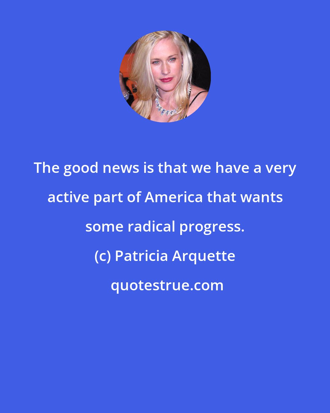 Patricia Arquette: The good news is that we have a very active part of America that wants some radical progress.
