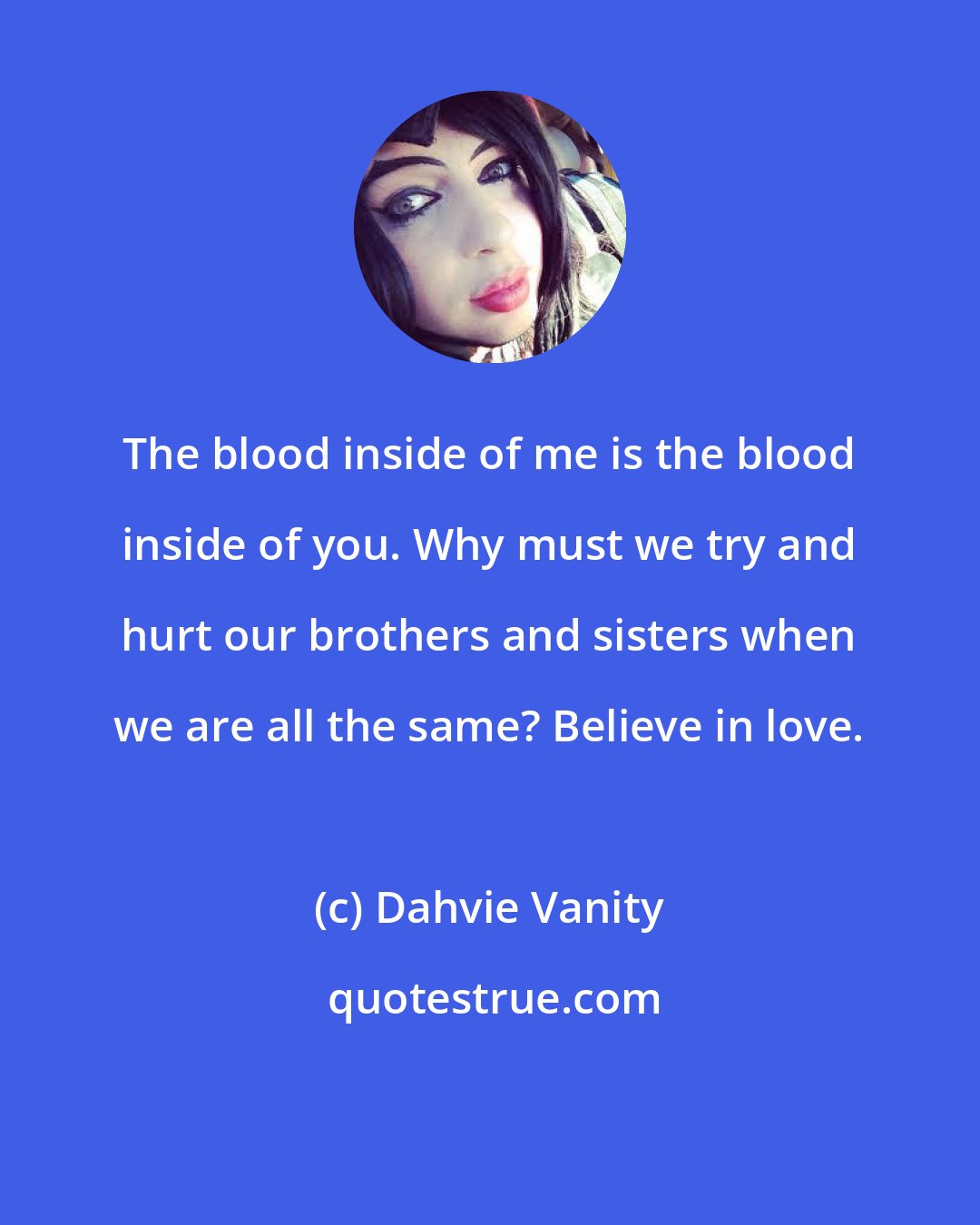 Dahvie Vanity: The blood inside of me is the blood inside of you. Why must we try and hurt our brothers and sisters when we are all the same? Believe in love.