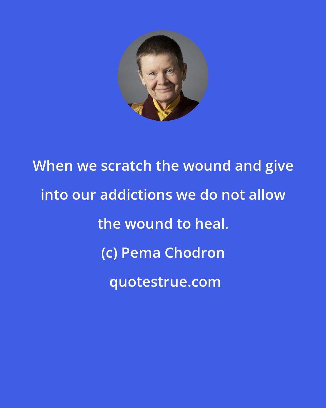 Pema Chodron: When we scratch the wound and give into our addictions we do not allow the wound to heal.