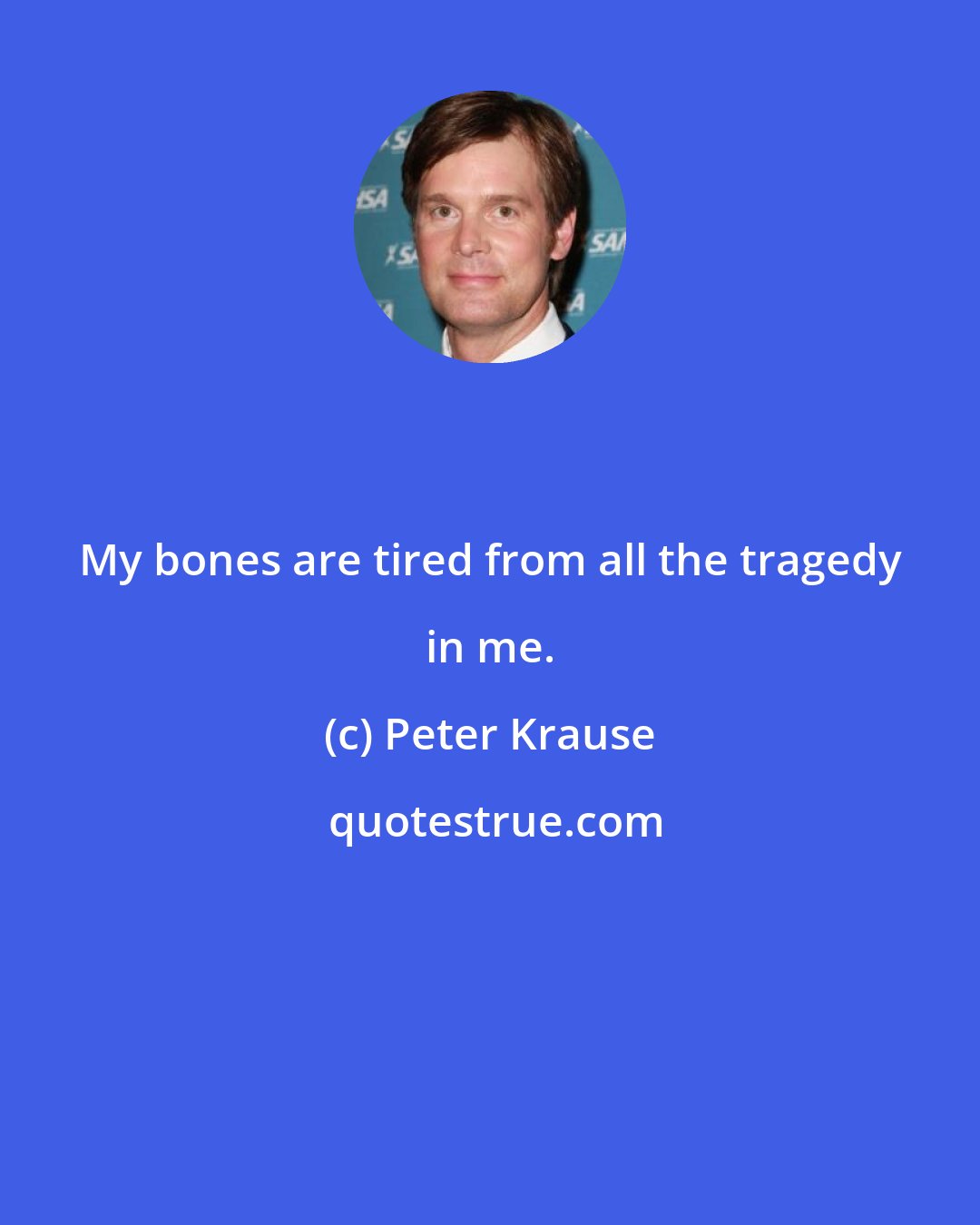 Peter Krause: My bones are tired from all the tragedy in me.