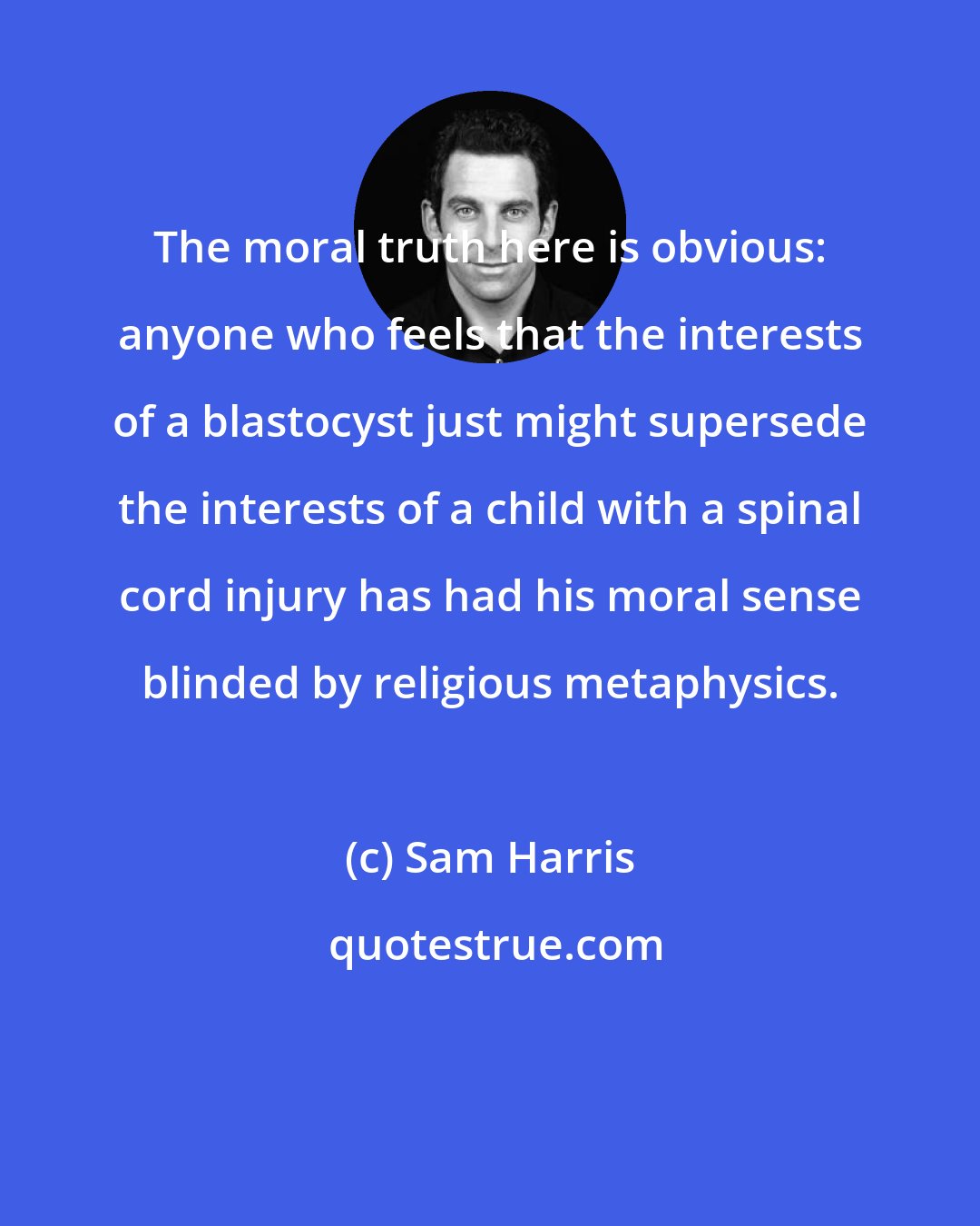 Sam Harris: The moral truth here is obvious: anyone who feels that the interests of a blastocyst just might supersede the interests of a child with a spinal cord injury has had his moral sense blinded by religious metaphysics.