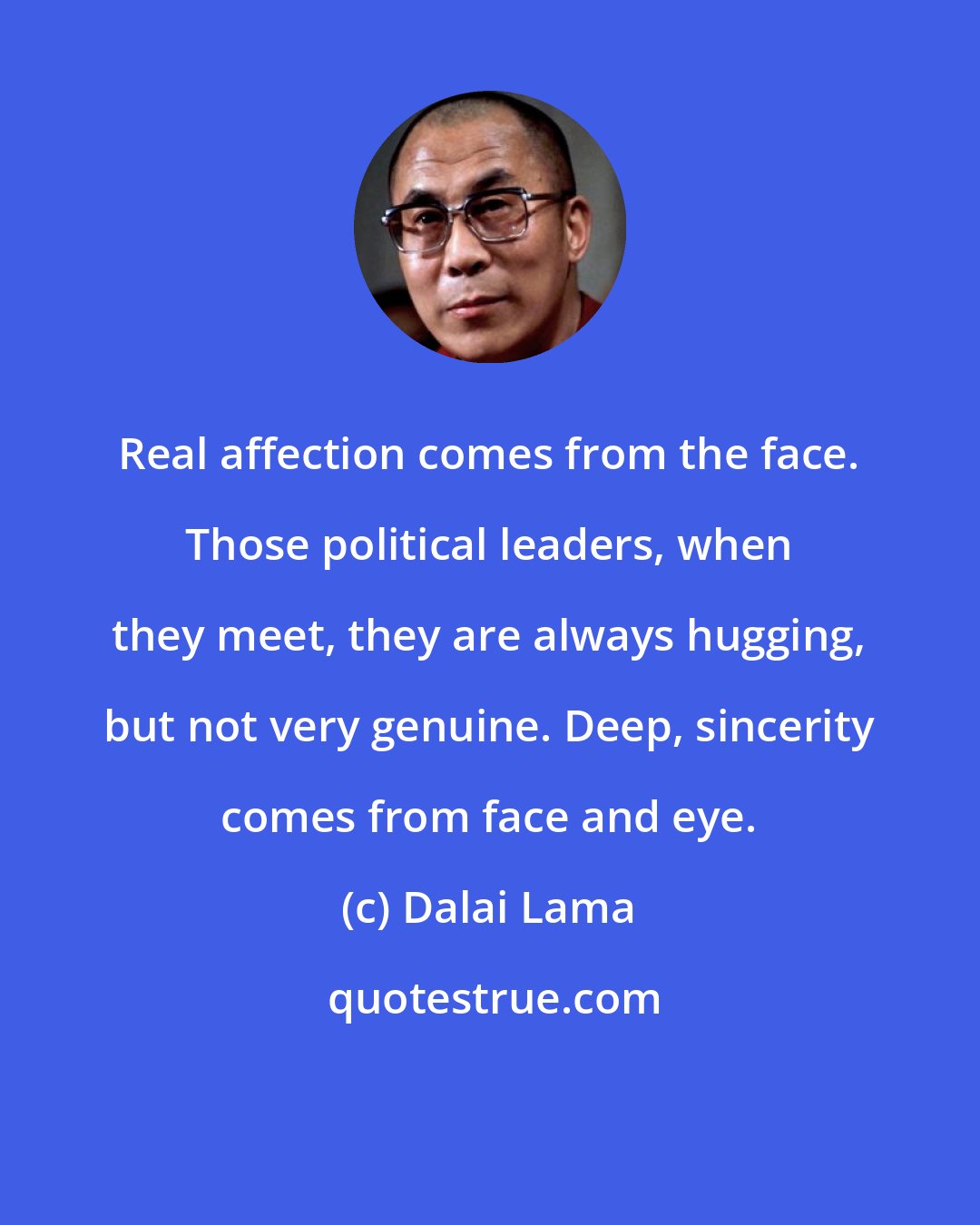 Dalai Lama: Real affection comes from the face. Those political leaders, when they meet, they are always hugging, but not very genuine. Deep, sincerity comes from face and eye.