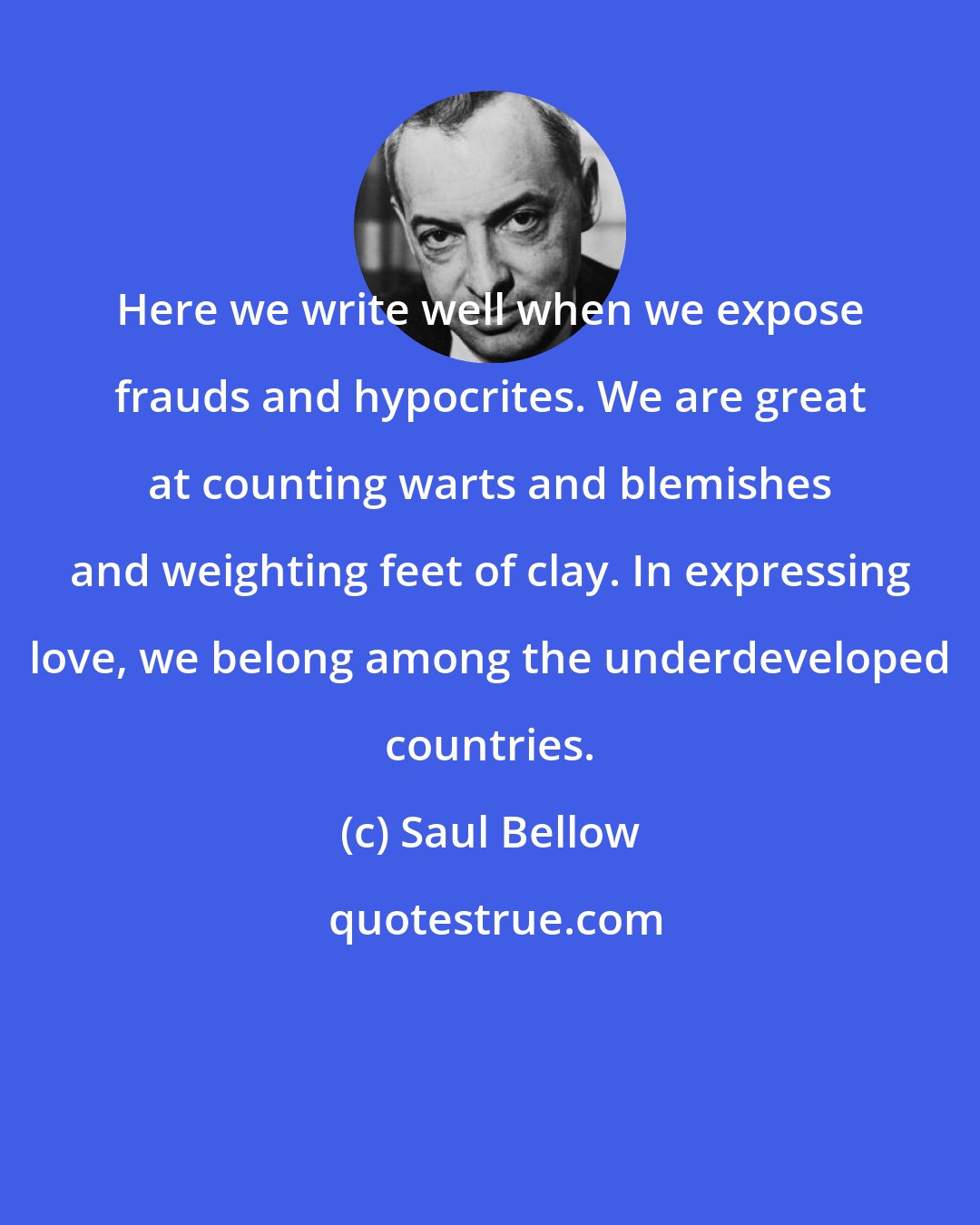 Saul Bellow: Here we write well when we expose frauds and hypocrites. We are great at counting warts and blemishes and weighting feet of clay. In expressing love, we belong among the underdeveloped countries.