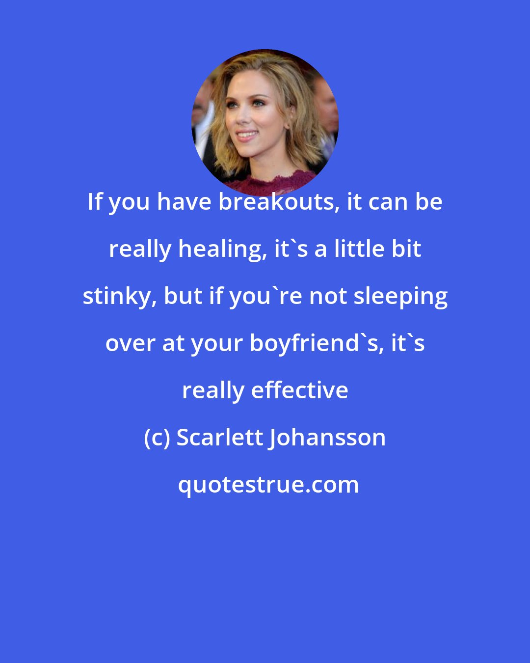 Scarlett Johansson: If you have breakouts, it can be really healing, it's a little bit stinky, but if you're not sleeping over at your boyfriend's, it's really effective