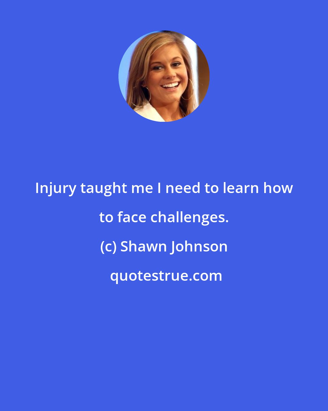 Shawn Johnson: Injury taught me I need to learn how to face challenges.