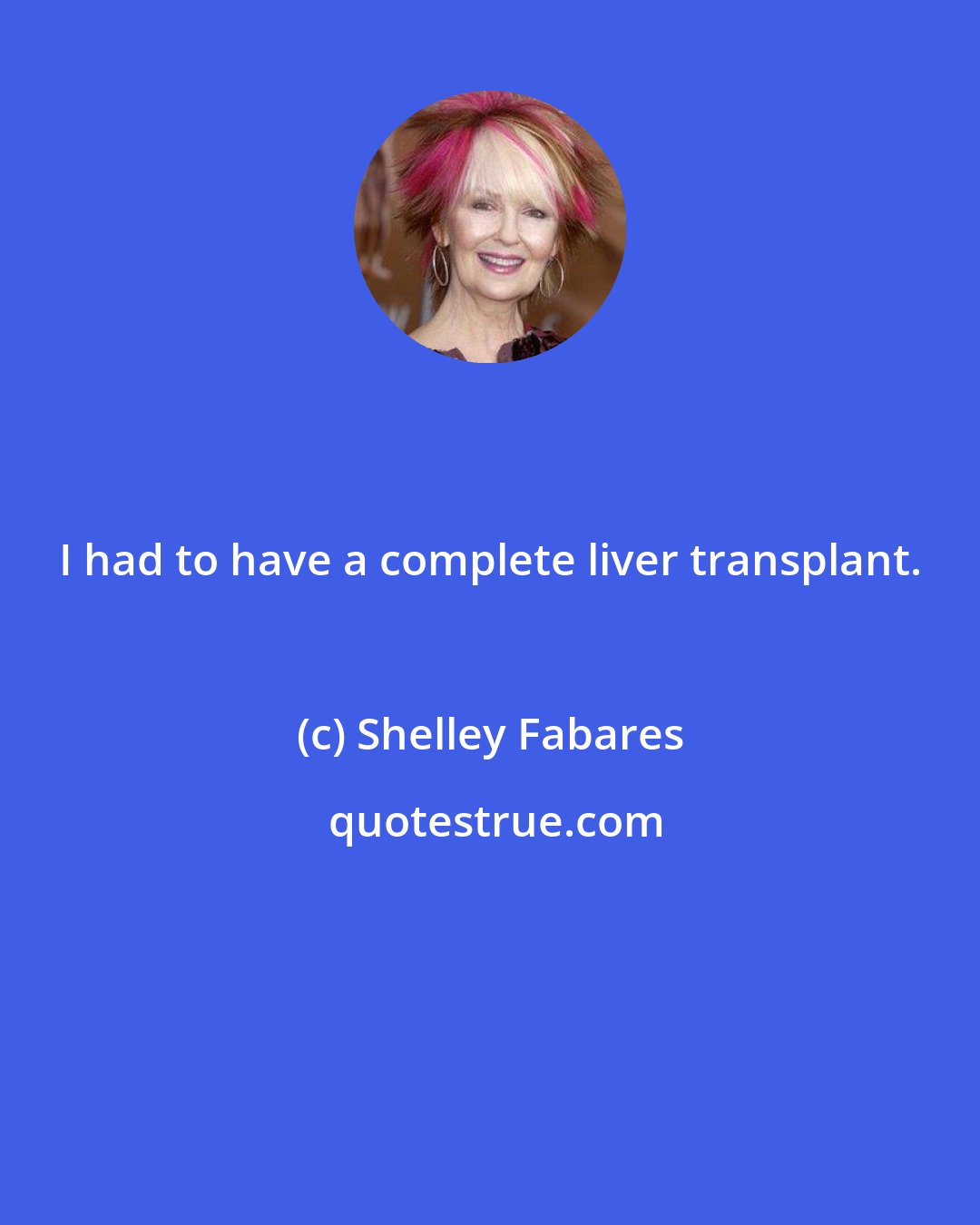 Shelley Fabares: I had to have a complete liver transplant.
