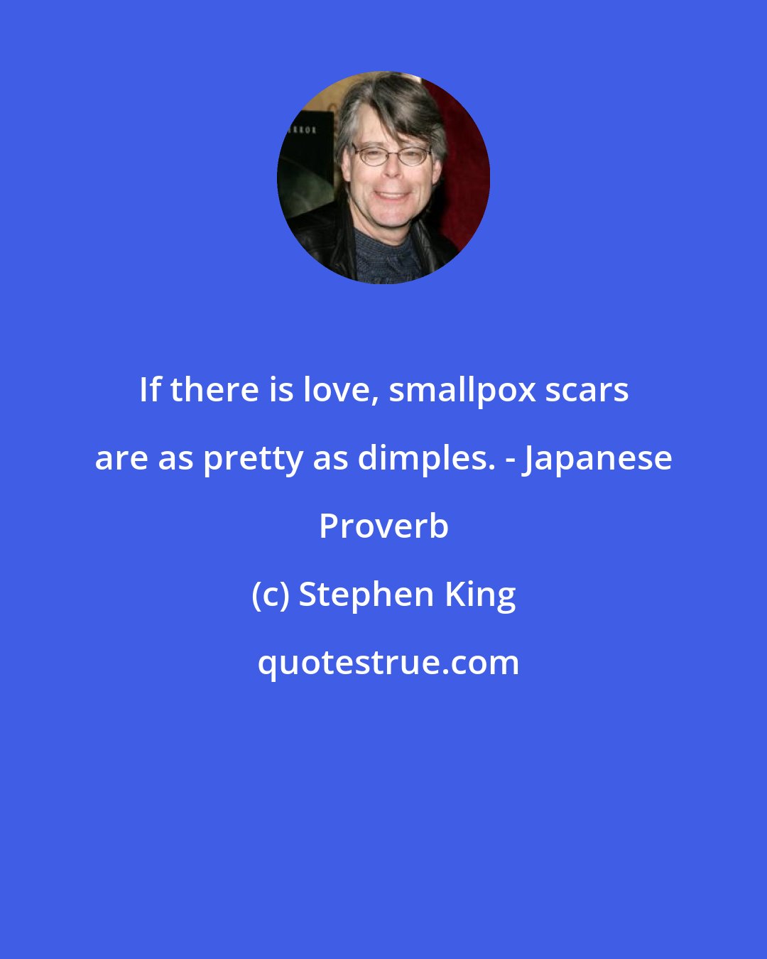 Stephen King: If there is love, smallpox scars are as pretty as dimples. - Japanese Proverb
