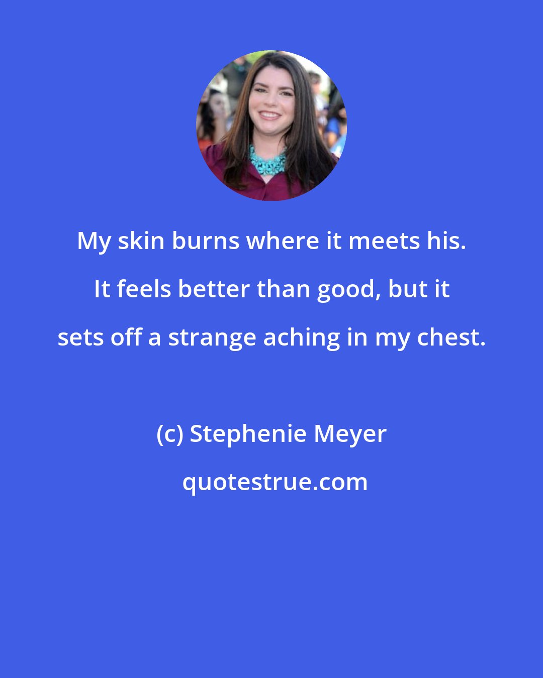 Stephenie Meyer: My skin burns where it meets his. It feels better than good, but it sets off a strange aching in my chest.