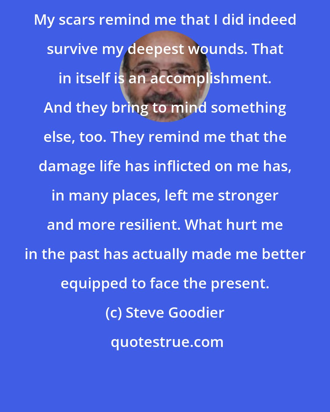 Steve Goodier: My scars remind me that I did indeed survive my deepest wounds. That in itself is an accomplishment. And they bring to mind something else, too. They remind me that the damage life has inflicted on me has, in many places, left me stronger and more resilient. What hurt me in the past has actually made me better equipped to face the present.