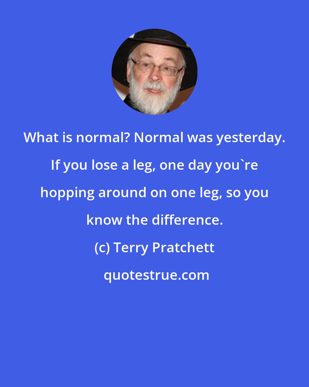 Terry Pratchett: What is normal? Normal was yesterday. If you lose a leg, one day you're hopping around on one leg, so you know the difference.