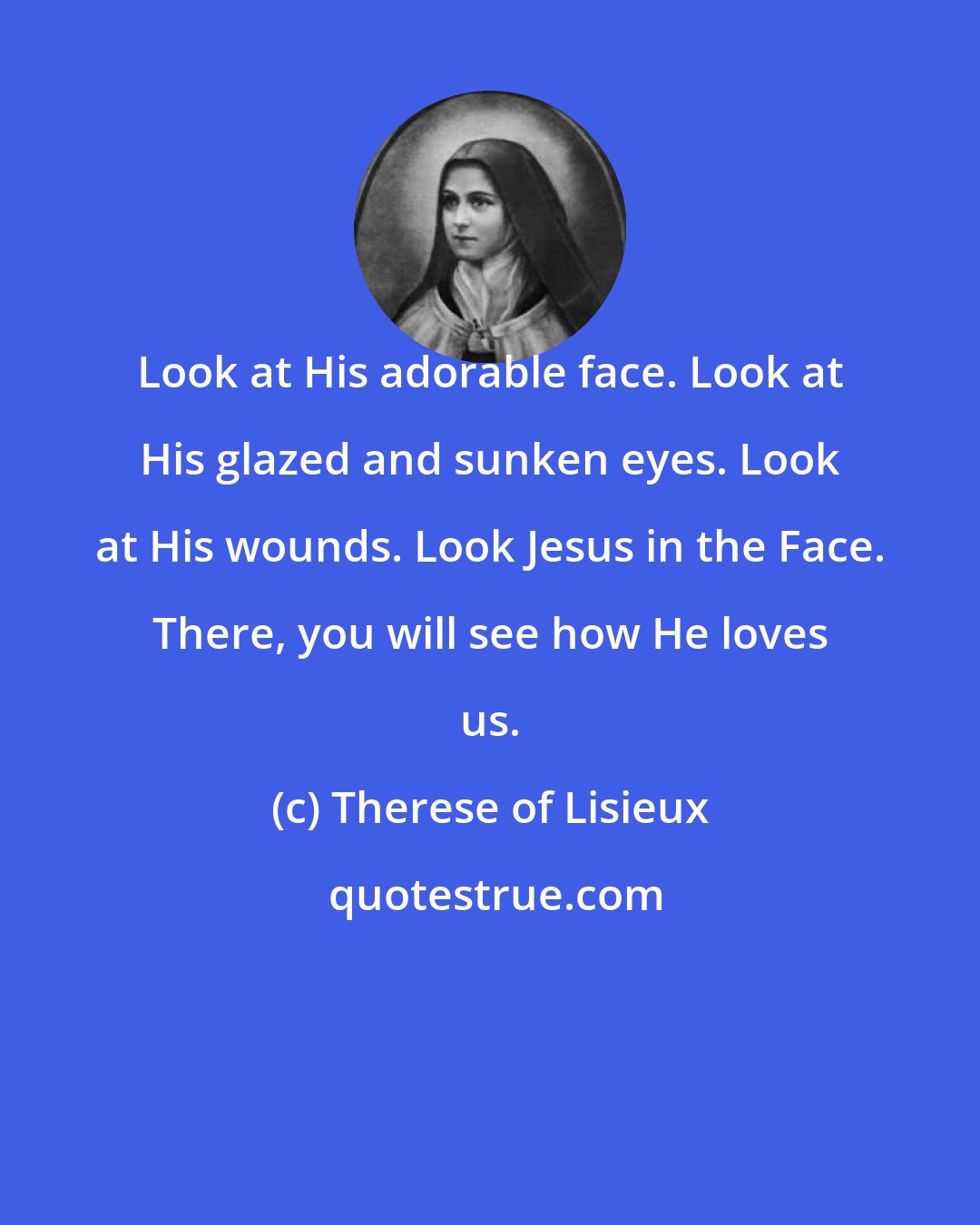 Therese of Lisieux: Look at His adorable face. Look at His glazed and sunken eyes. Look at His wounds. Look Jesus in the Face. There, you will see how He loves us.