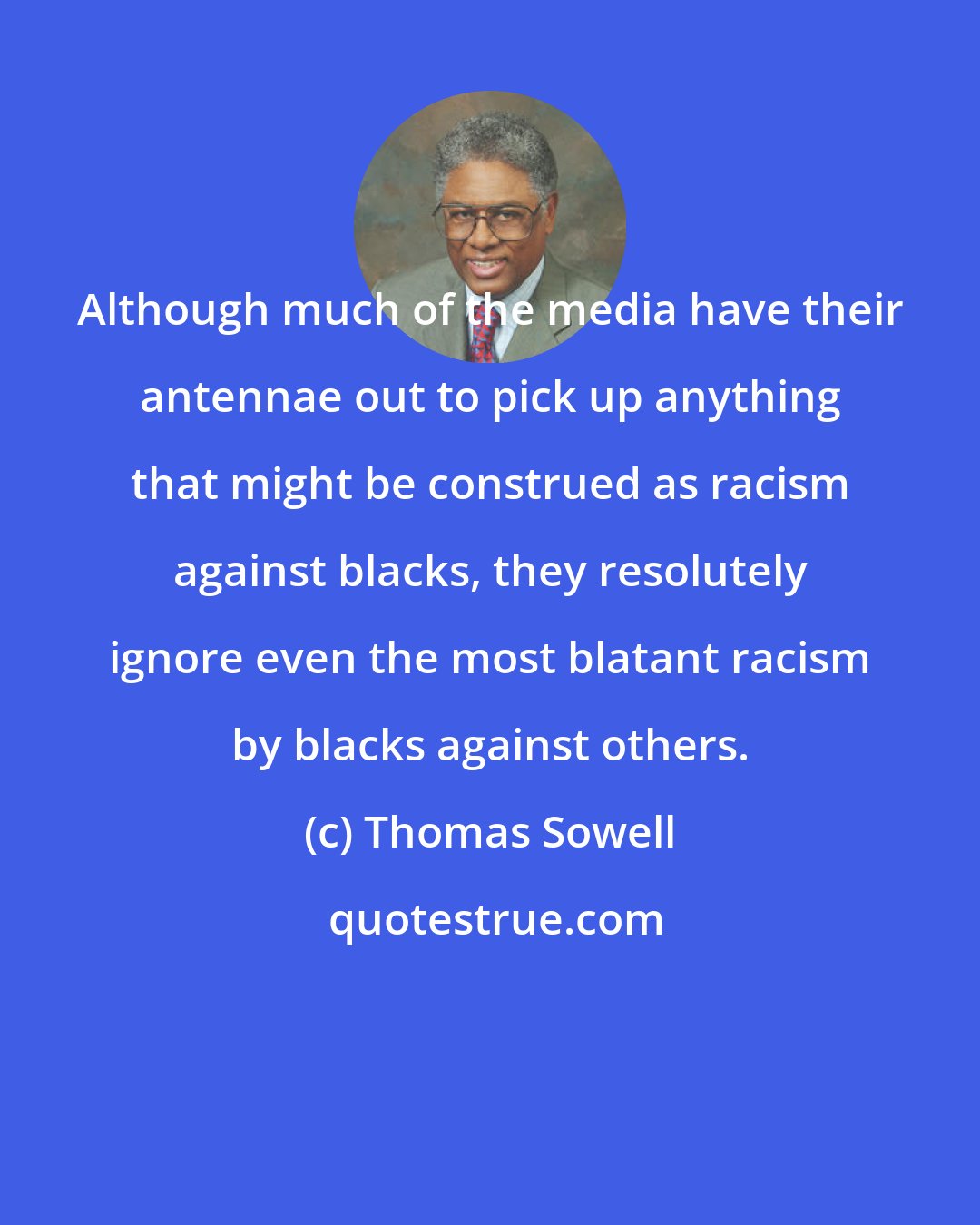 Thomas Sowell: Although much of the media have their antennae out to pick up anything that might be construed as racism against blacks, they resolutely ignore even the most blatant racism by blacks against others.