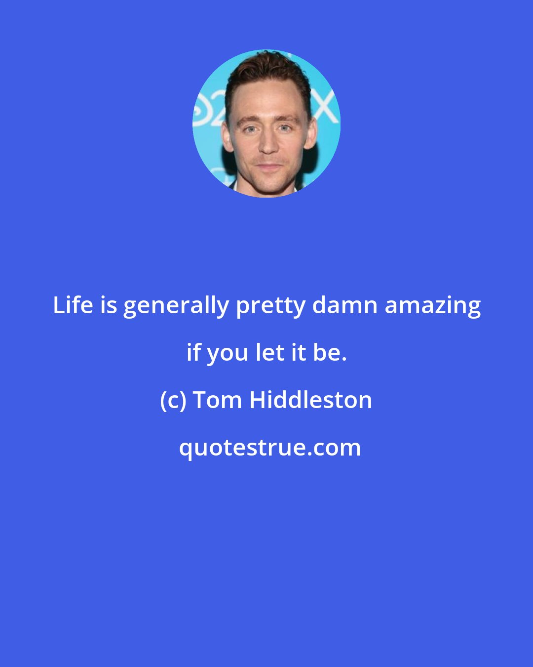 Tom Hiddleston: Life is generally pretty damn amazing if you let it be.