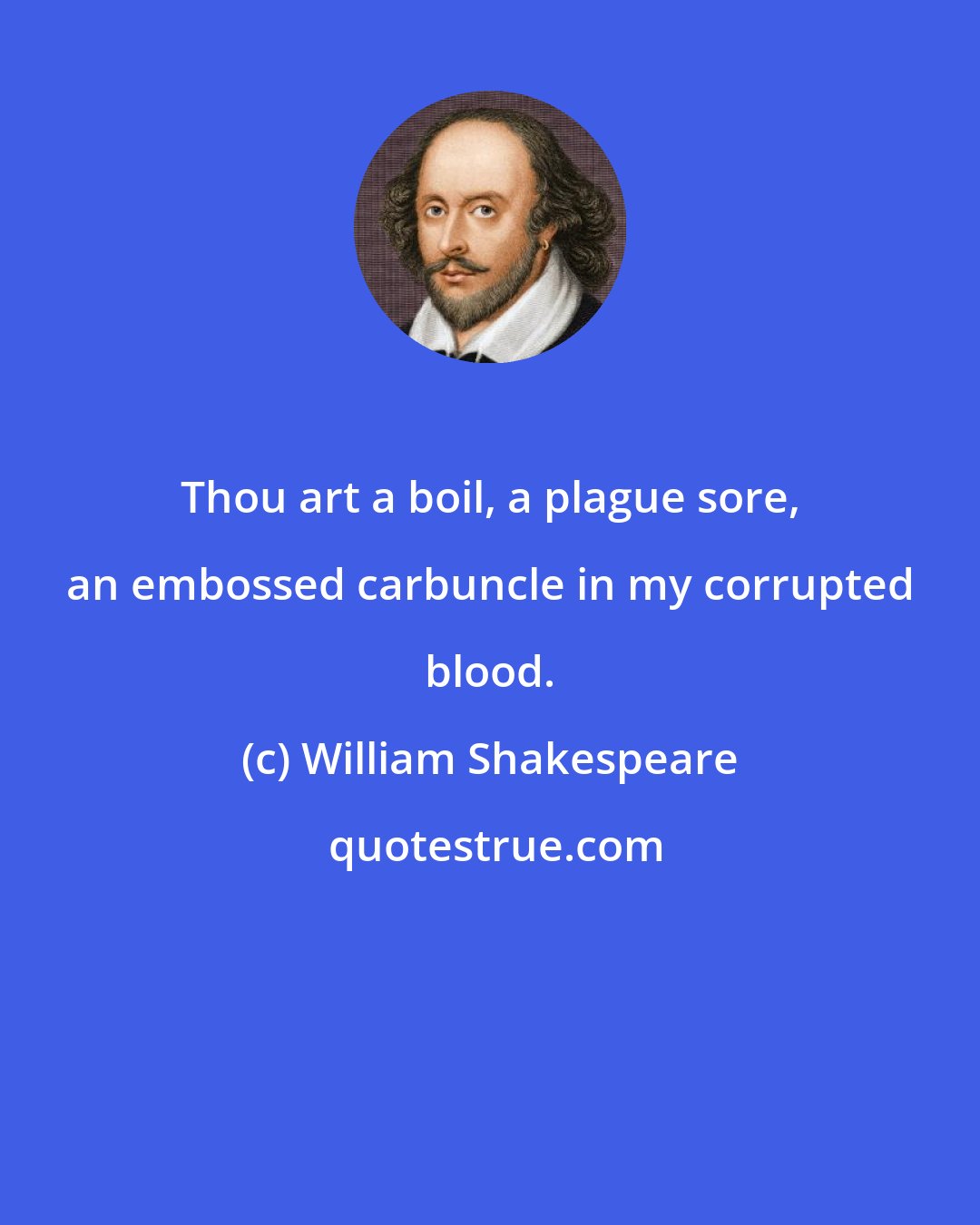 William Shakespeare: Thou art a boil, a plague sore, an embossed carbuncle in my corrupted blood.