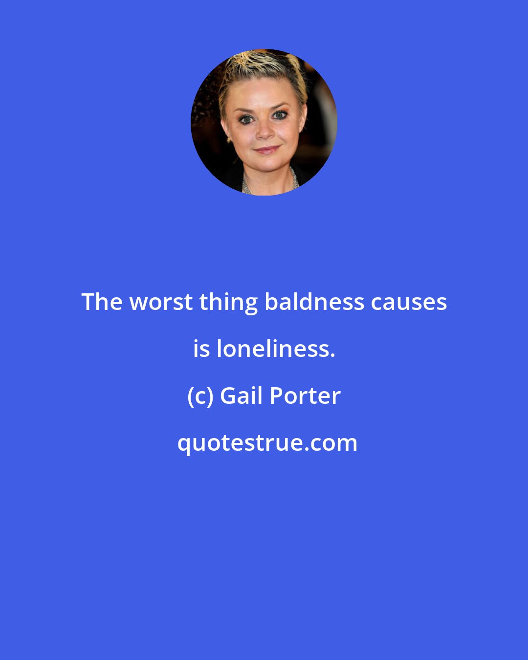 Gail Porter: The worst thing baldness causes is loneliness.