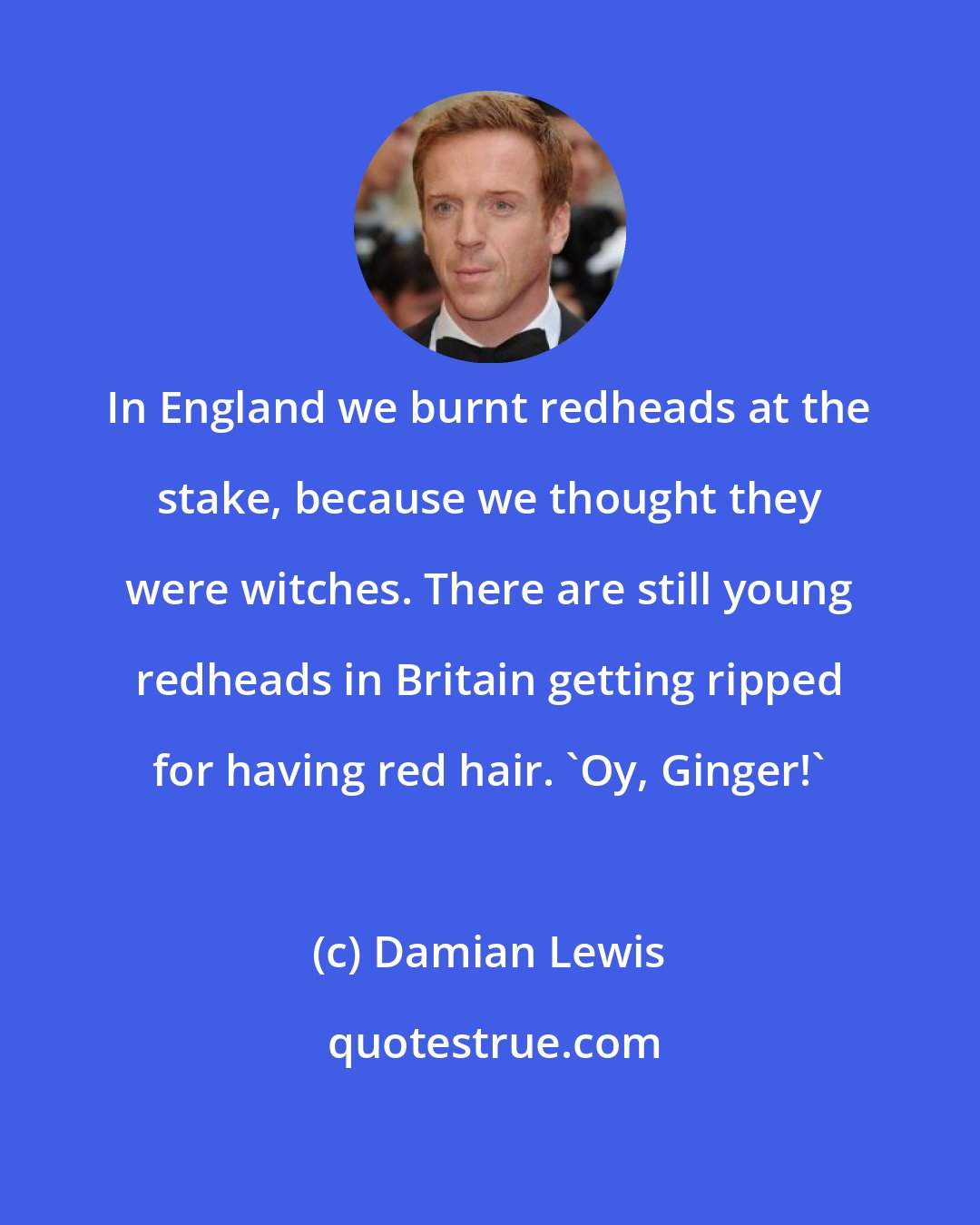 Damian Lewis: In England we burnt redheads at the stake, because we thought they were witches. There are still young redheads in Britain getting ripped for having red hair. 'Oy, Ginger!'