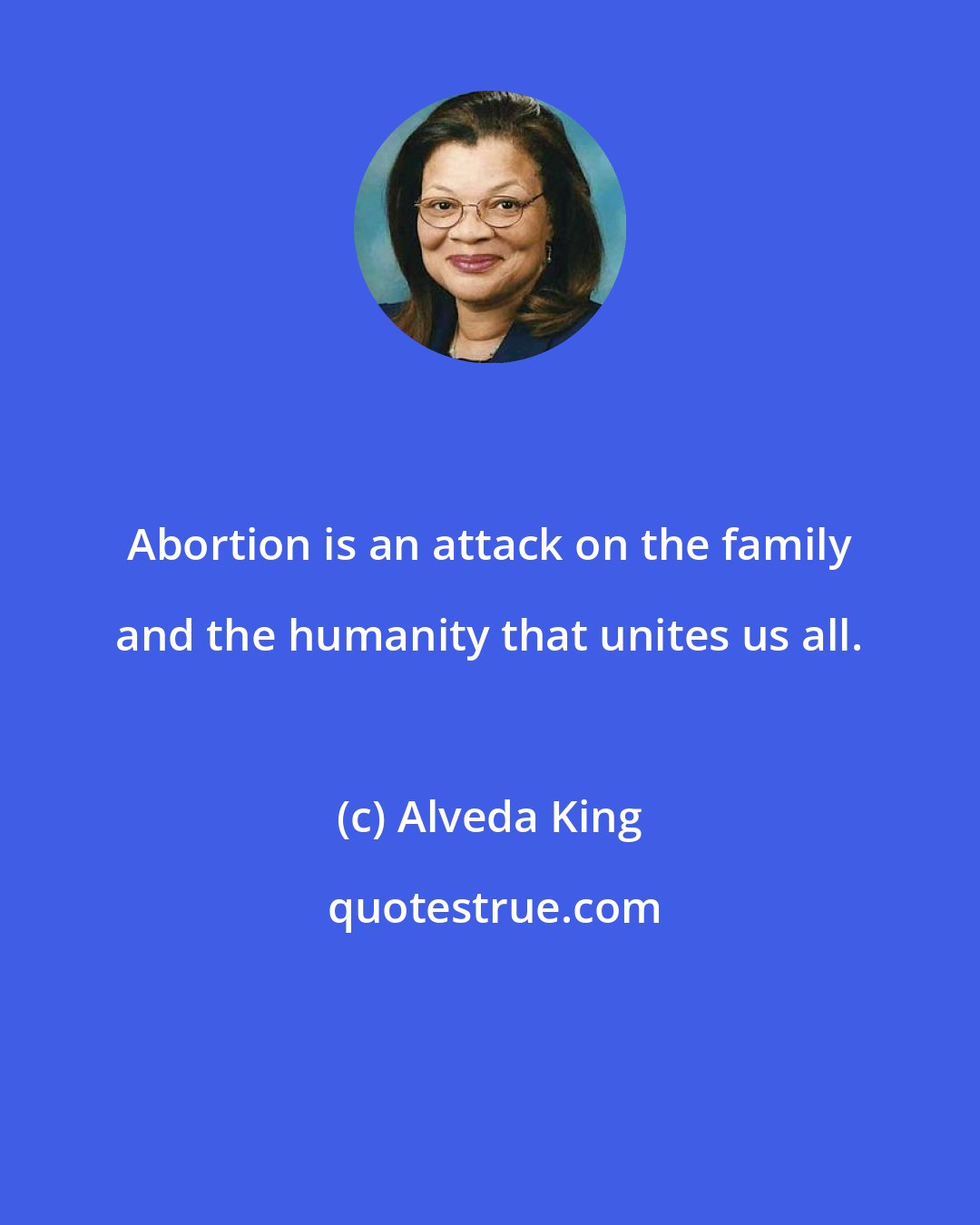 Alveda King: Abortion is an attack on the family and the humanity that unites us all.