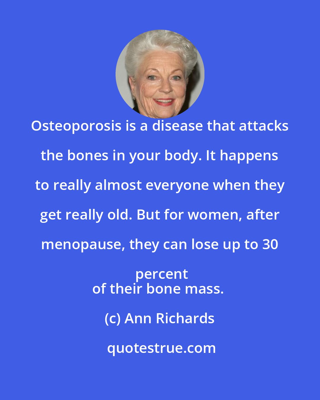 Ann Richards: Osteoporosis is a disease that attacks the bones in your body. It happens to really almost everyone when they get really old. But for women, after menopause, they can lose up to 30 percent
of their bone mass.