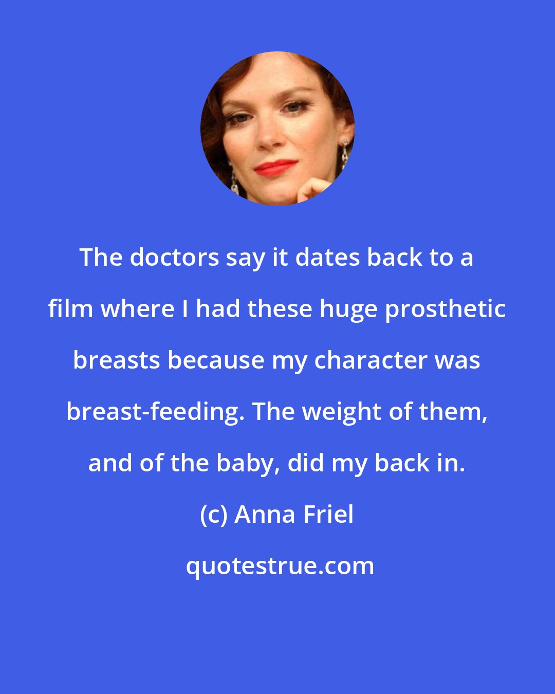 Anna Friel: The doctors say it dates back to a film where I had these huge prosthetic breasts because my character was breast-feeding. The weight of them, and of the baby, did my back in.