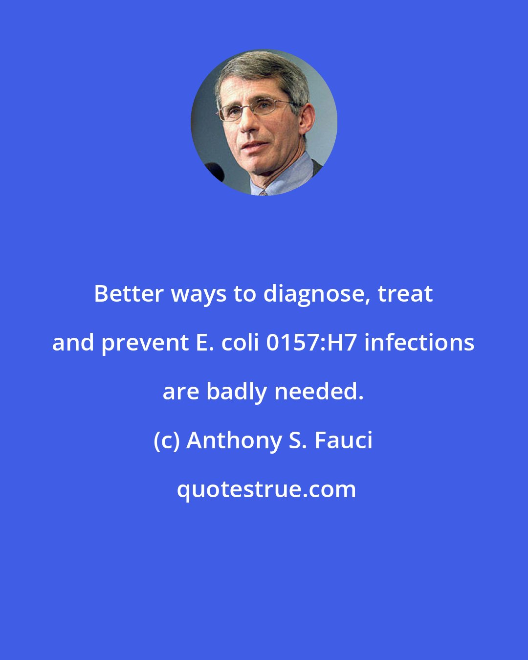 Anthony S. Fauci: Better ways to diagnose, treat and prevent E. coli 0157:H7 infections are badly needed.