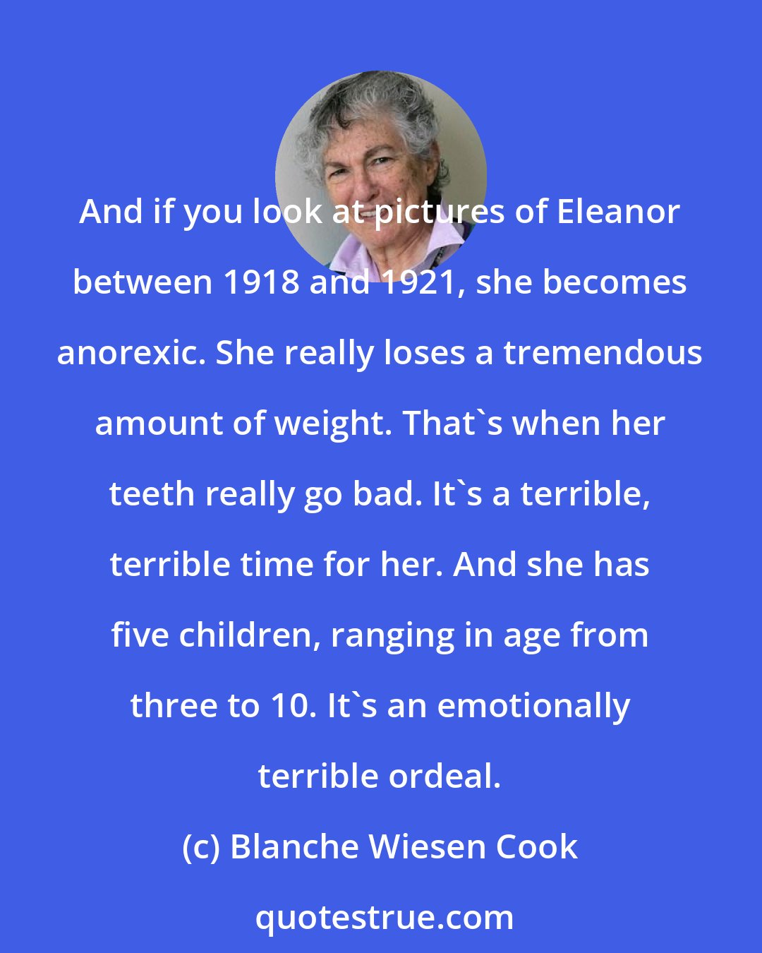 Blanche Wiesen Cook: And if you look at pictures of Eleanor between 1918 and 1921, she becomes anorexic. She really loses a tremendous amount of weight. That's when her teeth really go bad. It's a terrible, terrible time for her. And she has five children, ranging in age from three to 10. It's an emotionally terrible ordeal.