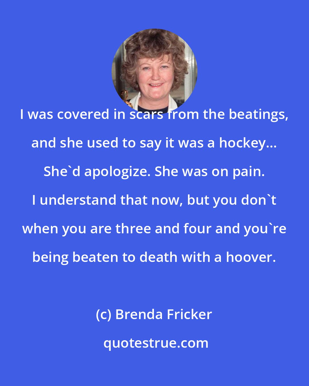 Brenda Fricker: I was covered in scars from the beatings, and she used to say it was a hockey... She'd apologize. She was on pain. I understand that now, but you don't when you are three and four and you're being beaten to death with a hoover.