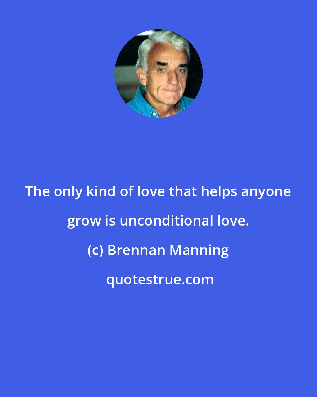 Brennan Manning: The only kind of love that helps anyone grow is unconditional love.