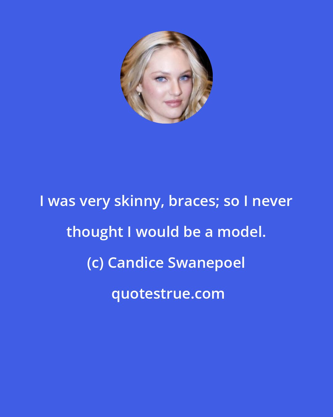 Candice Swanepoel: I was very skinny, braces; so I never thought I would be a model.