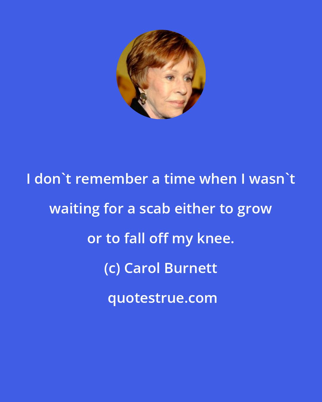 Carol Burnett: I don't remember a time when I wasn't waiting for a scab either to grow or to fall off my knee.