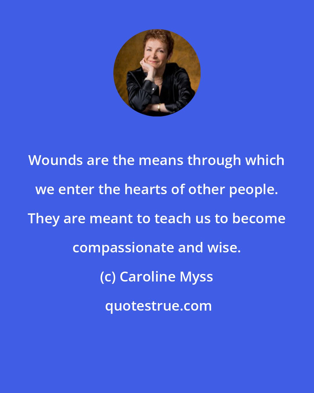 Caroline Myss: Wounds are the means through which we enter the hearts of other people. They are meant to teach us to become compassionate and wise.