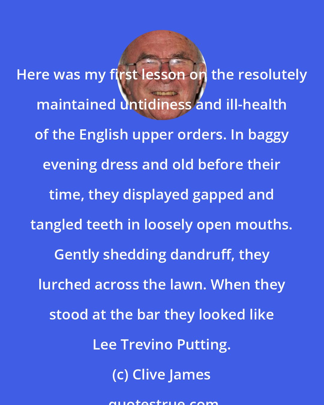 Clive James: Here was my first lesson on the resolutely maintained untidiness and ill-health of the English upper orders. In baggy evening dress and old before their time, they displayed gapped and tangled teeth in loosely open mouths. Gently shedding dandruff, they lurched across the lawn. When they stood at the bar they looked like Lee Trevino Putting.