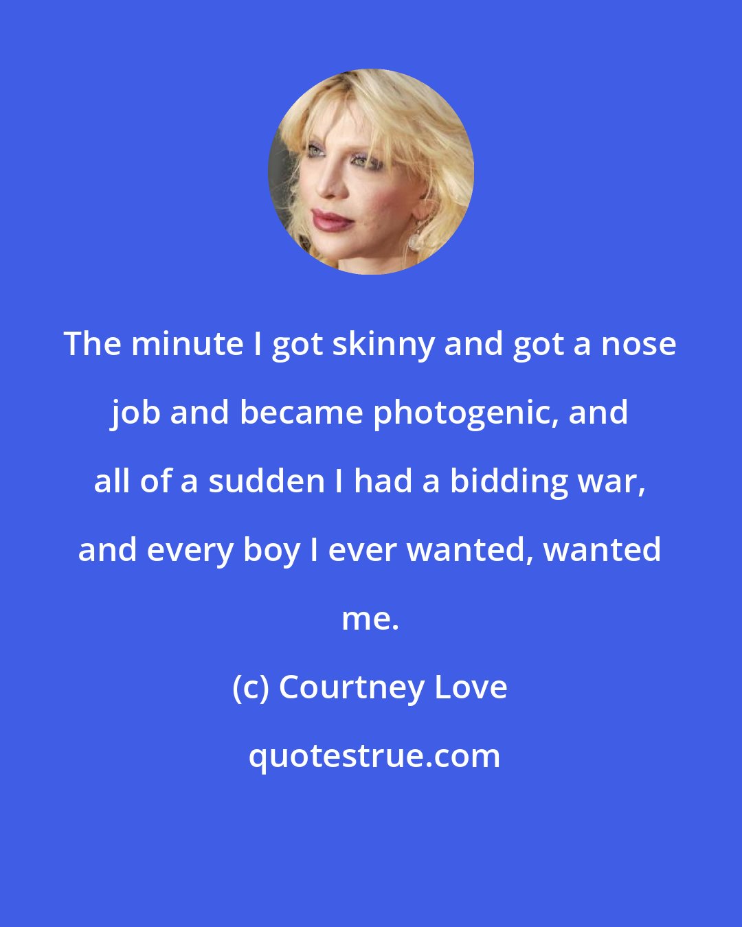 Courtney Love: The minute I got skinny and got a nose job and became photogenic, and all of a sudden I had a bidding war, and every boy I ever wanted, wanted me.