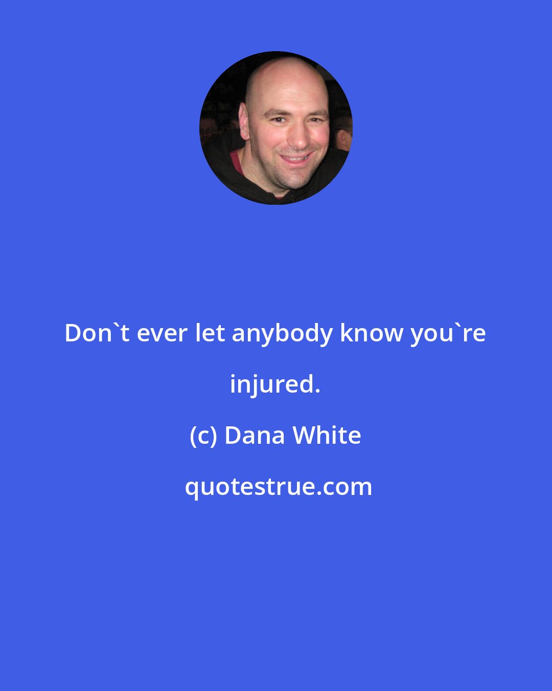 Dana White: Don't ever let anybody know you're injured.