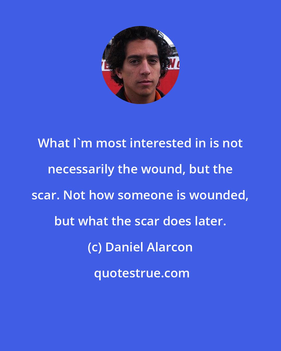 Daniel Alarcon: What I'm most interested in is not necessarily the wound, but the scar. Not how someone is wounded, but what the scar does later.