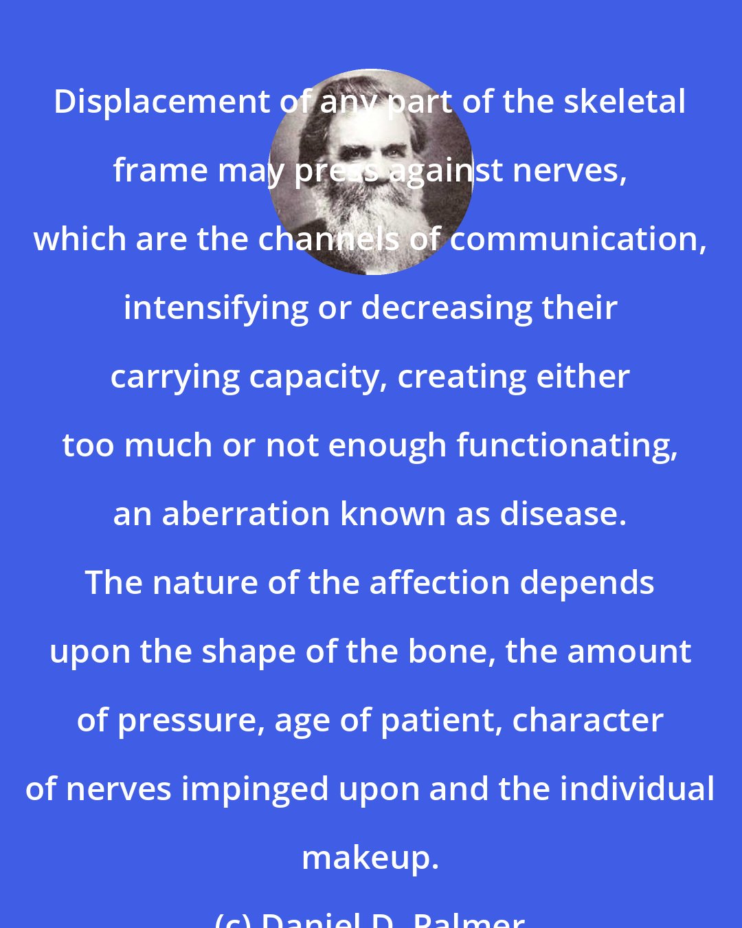 Daniel D. Palmer: Displacement of any part of the skeletal frame may press against nerves, which are the channels of communication, intensifying or decreasing their carrying capacity, creating either too much or not enough functionating, an aberration known as disease. The nature of the affection depends upon the shape of the bone, the amount of pressure, age of patient, character of nerves impinged upon and the individual makeup.