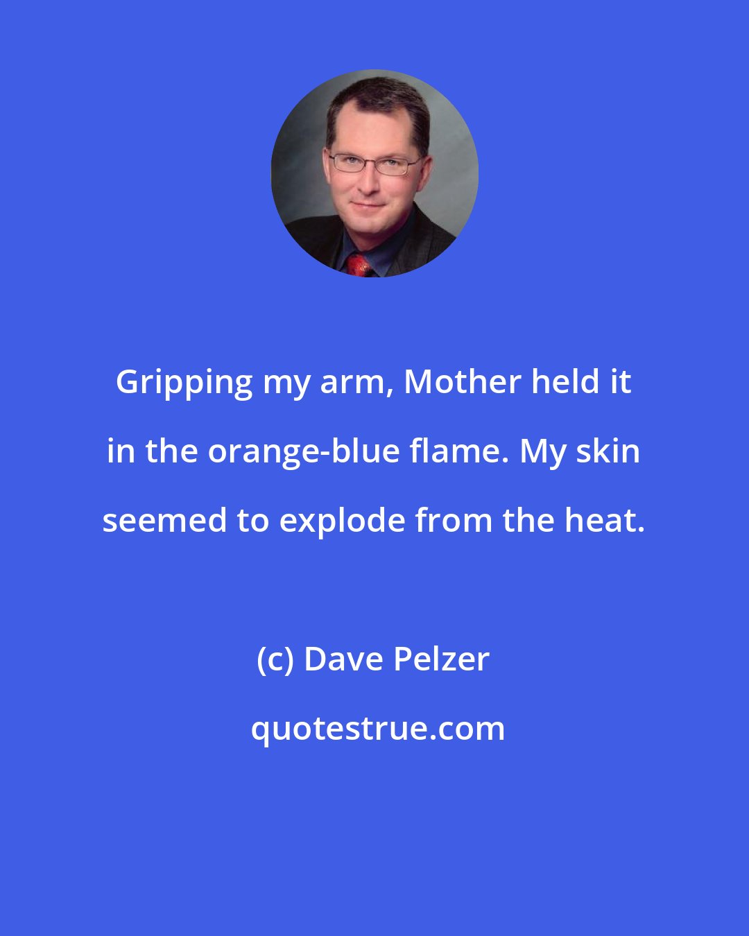 Dave Pelzer: Gripping my arm, Mother held it in the orange-blue flame. My skin seemed to explode from the heat.