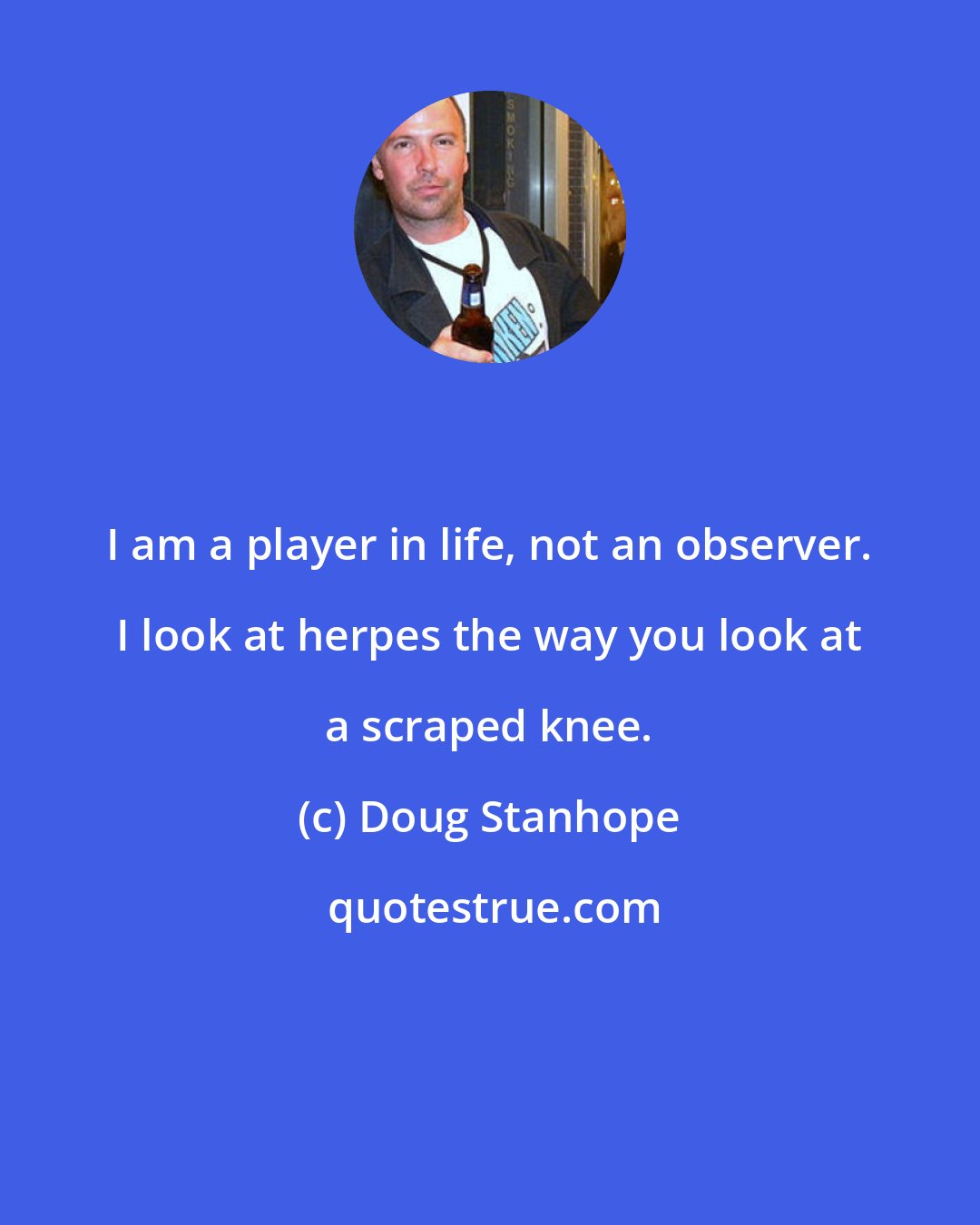 Doug Stanhope: I am a player in life, not an observer. I look at herpes the way you look at a scraped knee.