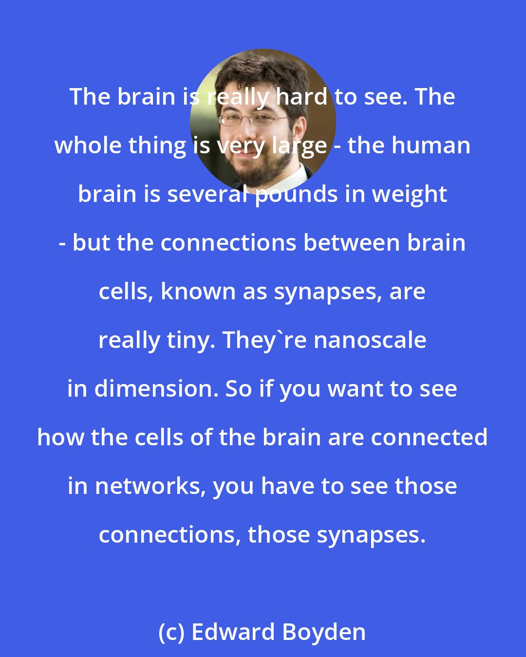 Edward Boyden: The brain is really hard to see. The whole thing is very large - the human brain is several pounds in weight - but the connections between brain cells, known as synapses, are really tiny. They're nanoscale in dimension. So if you want to see how the cells of the brain are connected in networks, you have to see those connections, those synapses.