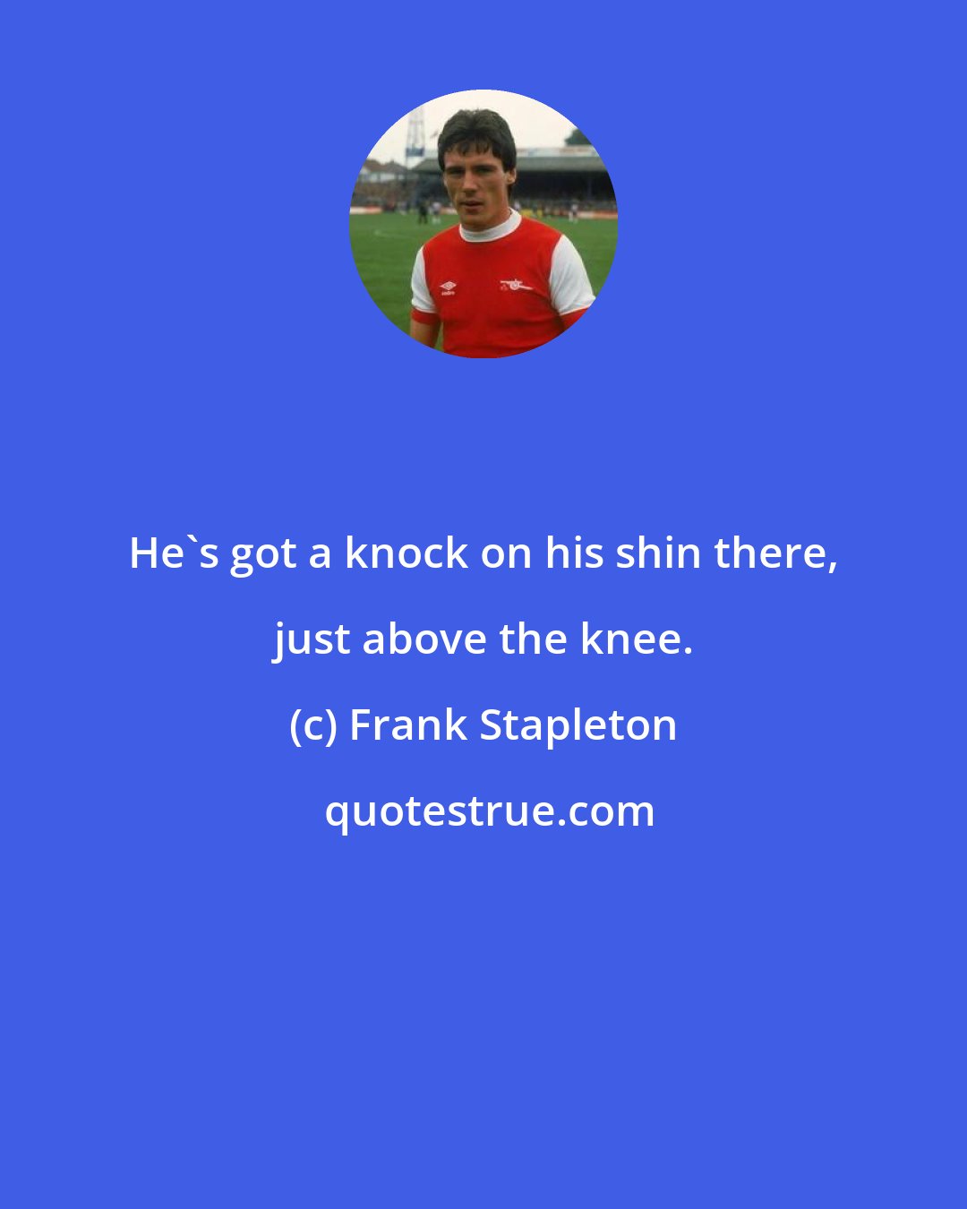 Frank Stapleton: He's got a knock on his shin there, just above the knee.