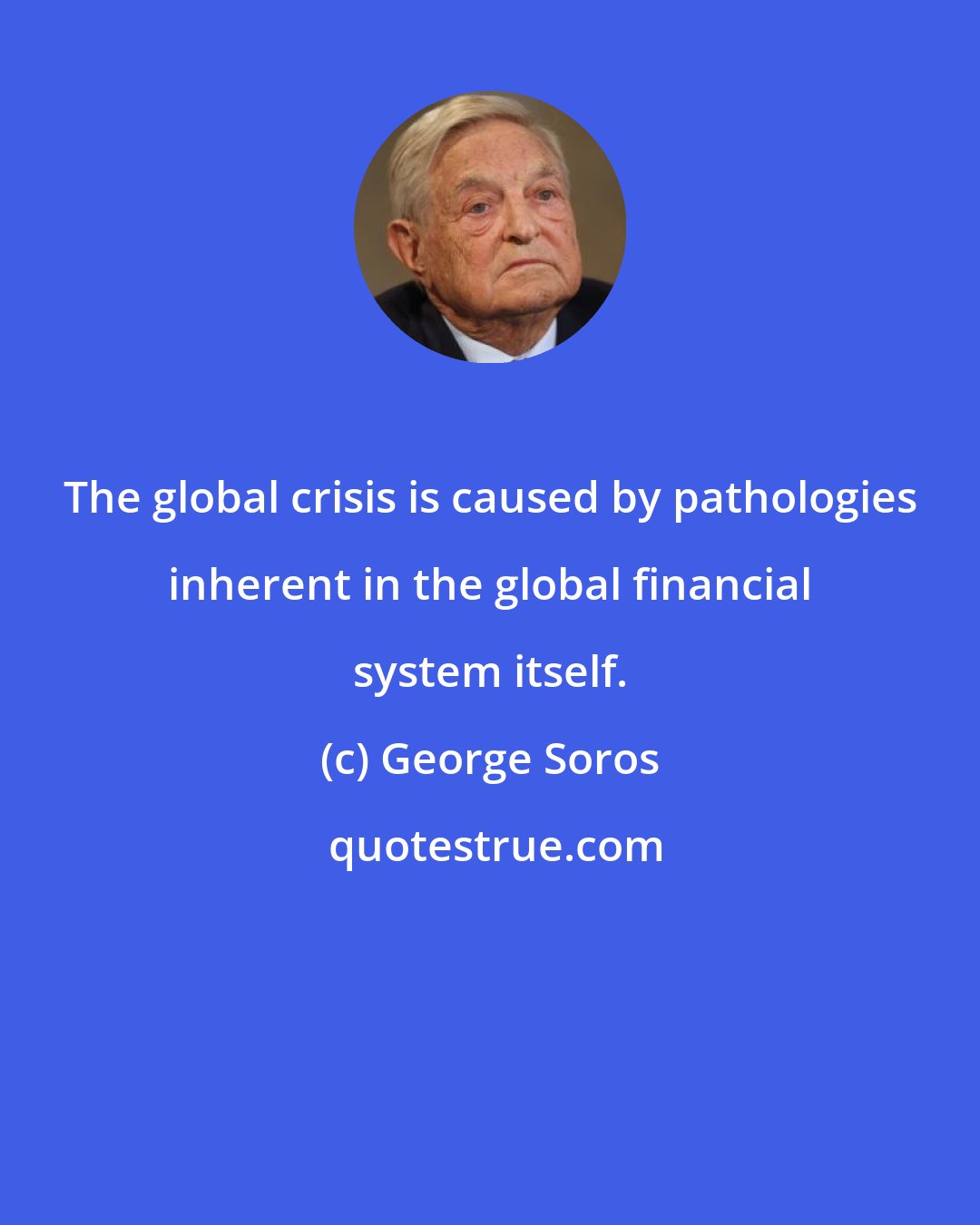 George Soros: The global crisis is caused by pathologies inherent in the global financial system itself.