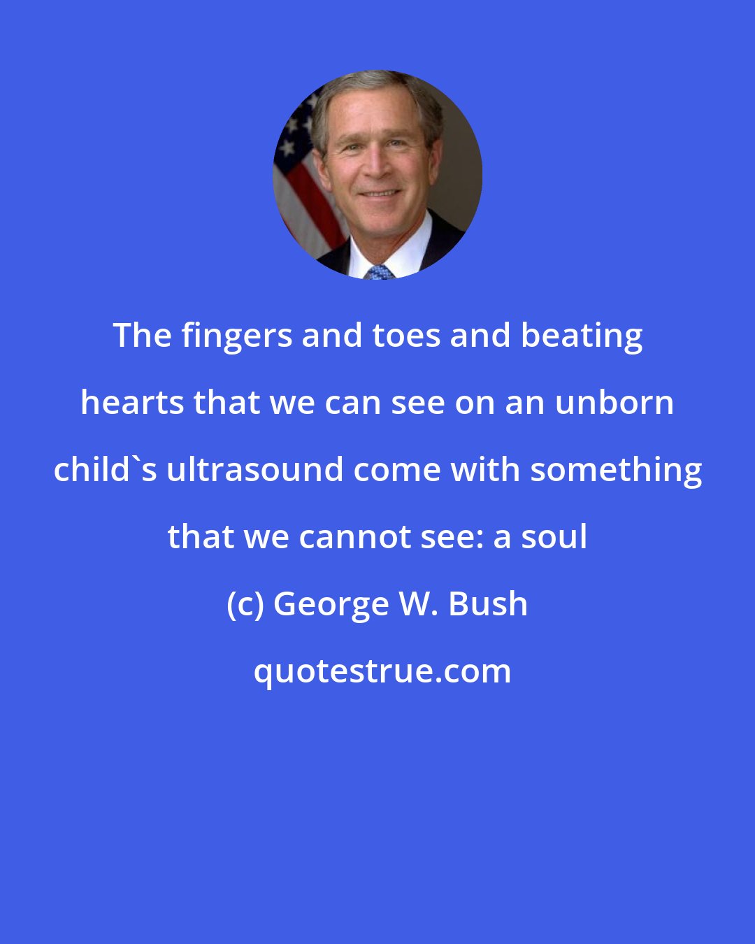 George W. Bush: The fingers and toes and beating hearts that we can see on an unborn child's ultrasound come with something that we cannot see: a soul