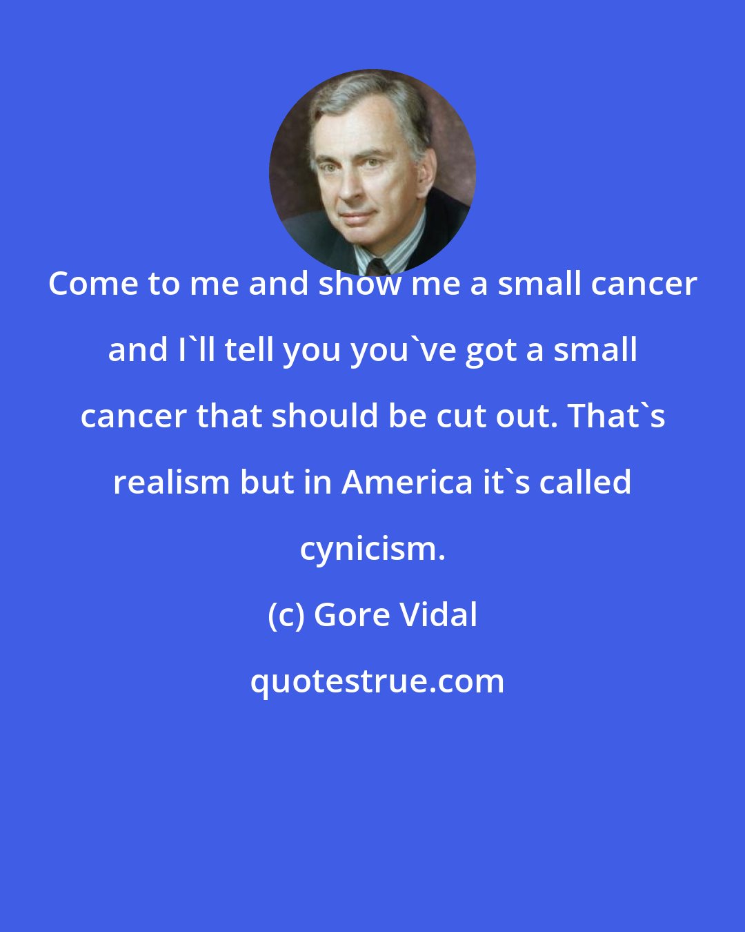 Gore Vidal: Come to me and show me a small cancer and I'll tell you you've got a small cancer that should be cut out. That's realism but in America it's called cynicism.