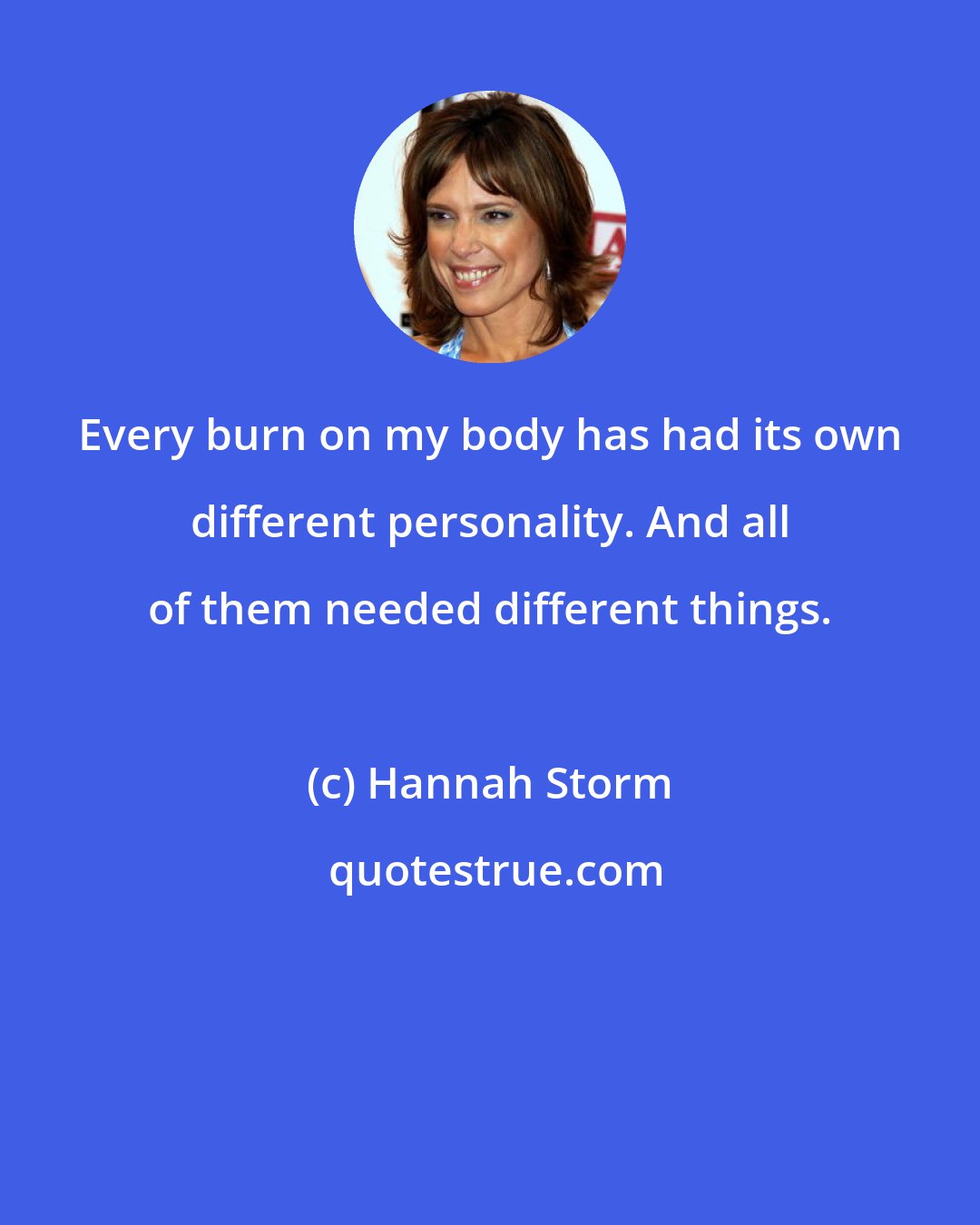 Hannah Storm: Every burn on my body has had its own different personality. And all of them needed different things.