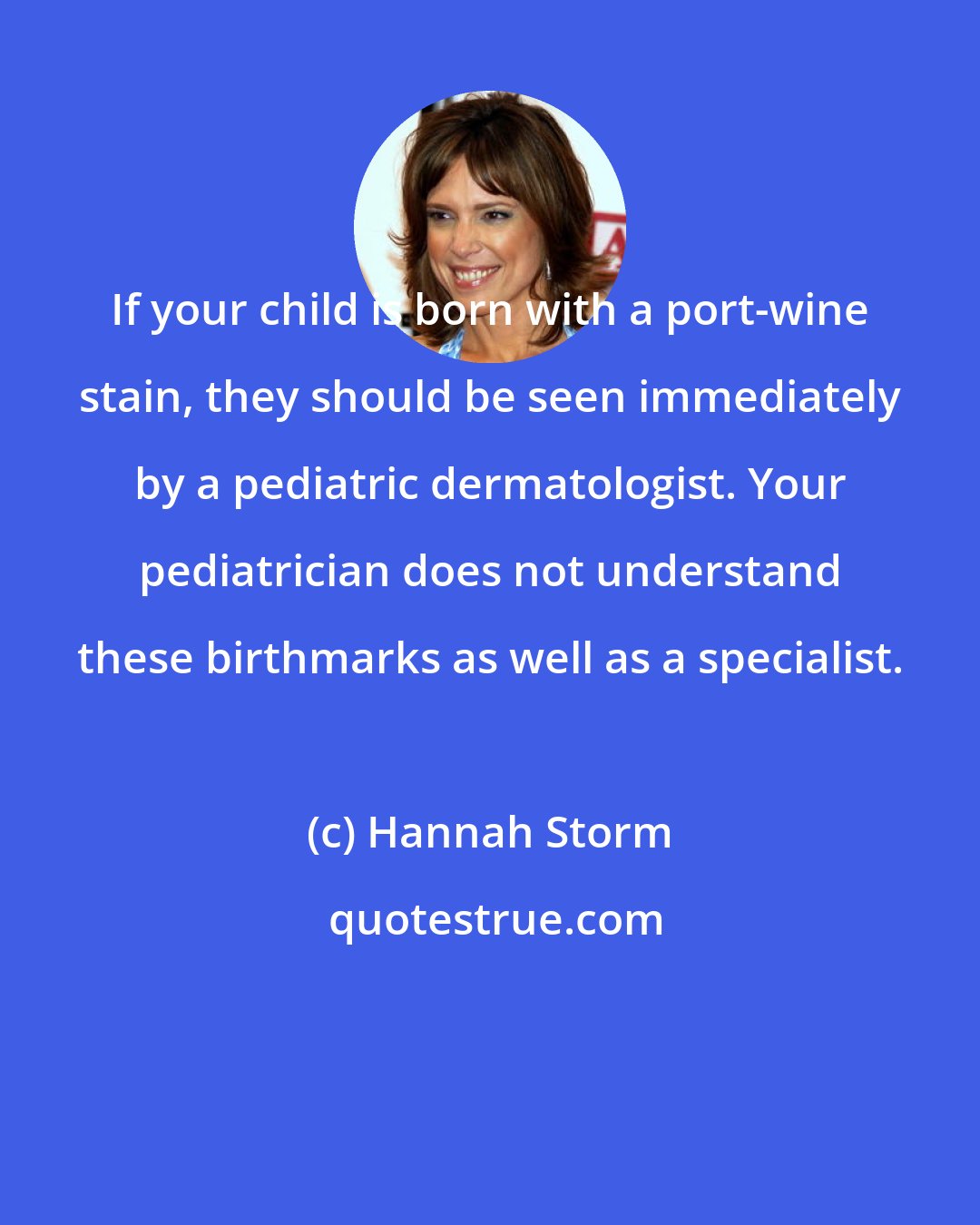 Hannah Storm: If your child is born with a port-wine stain, they should be seen immediately by a pediatric dermatologist. Your pediatrician does not understand these birthmarks as well as a specialist.