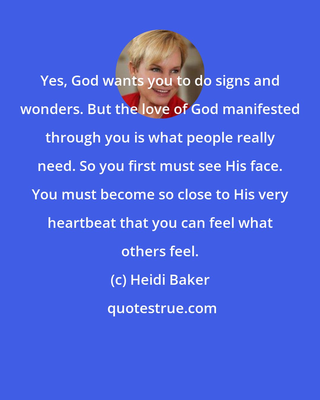 Heidi Baker: Yes, God wants you to do signs and wonders. But the love of God manifested through you is what people really need. So you first must see His face. You must become so close to His very heartbeat that you can feel what others feel.