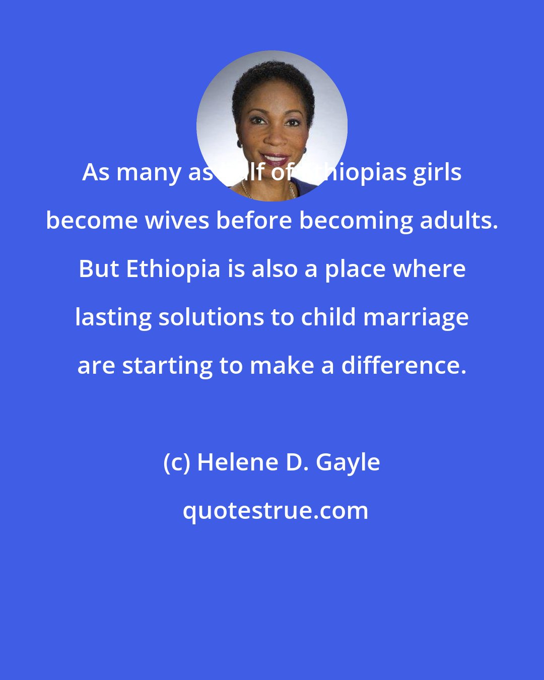 Helene D. Gayle: As many as half of Ethiopias girls become wives before becoming adults. But Ethiopia is also a place where lasting solutions to child marriage are starting to make a difference.