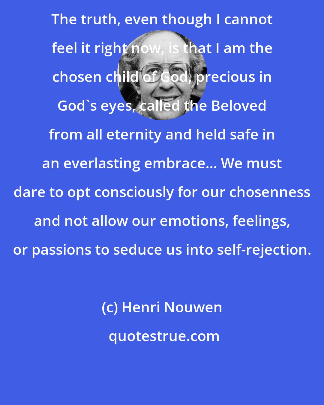 Henri Nouwen: The truth, even though I cannot feel it right now, is that I am the chosen child of God, precious in God's eyes, called the Beloved from all eternity and held safe in an everlasting embrace... We must dare to opt consciously for our chosenness and not allow our emotions, feelings, or passions to seduce us into self-rejection.